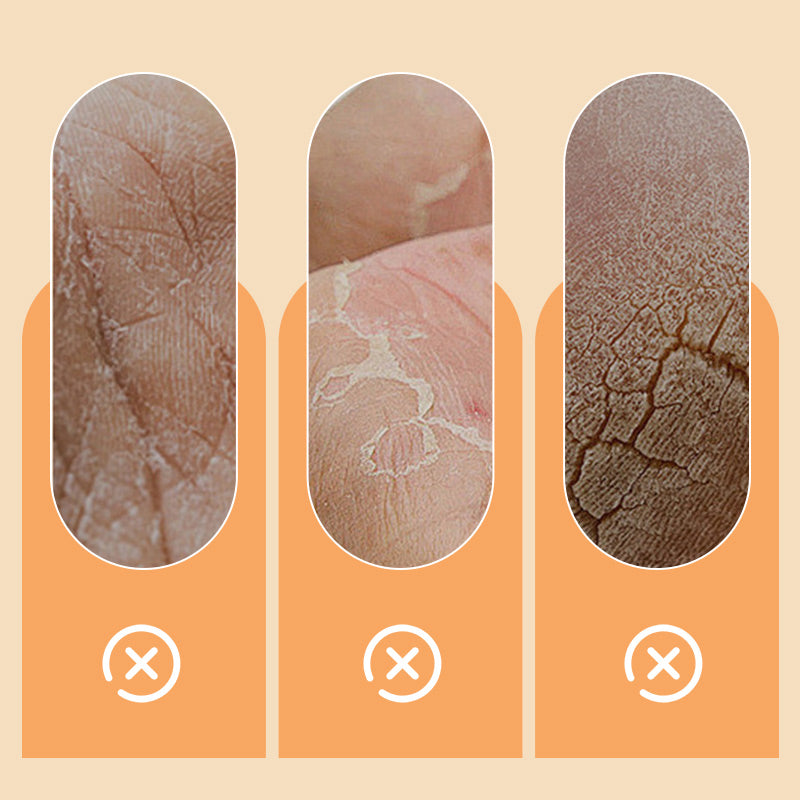 💥Der Sonderverkauf dieser Woche 💕🎁Anti-Dryness feuchtigkeitsspendende Handcreme mit Pferdeöl